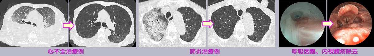 施設内治療例